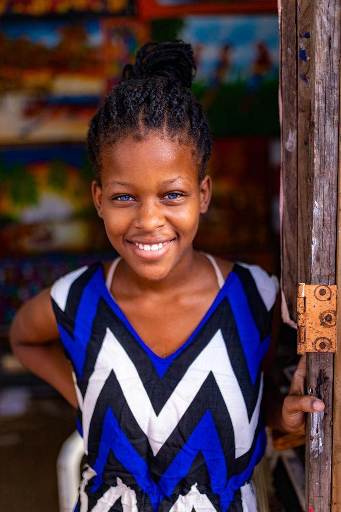 Чернокожая девочка с редкой мутацией Фотография, Доминикана, Чернокожие, Портрет, Мутация, Голубые глаза, Длиннопост