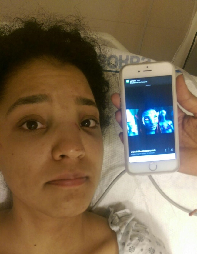 Со сломанным носом теперь проще косплеить аватаршу!