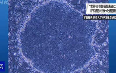Cell transplantation for spinal cord injuries: first tests conducted - news, Japan, Scientists, Transfer, Stem cells