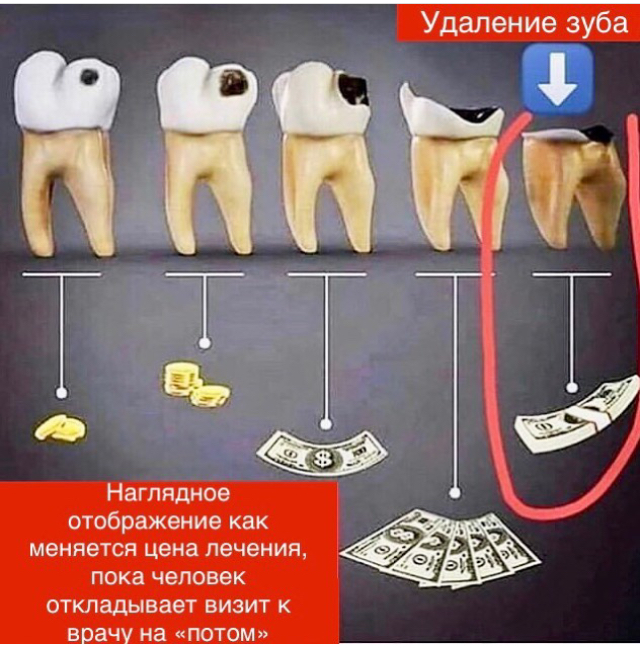 Prices for dental treatment, visually! - Dentistry, Laziness, Stupidity, Prices, High prices