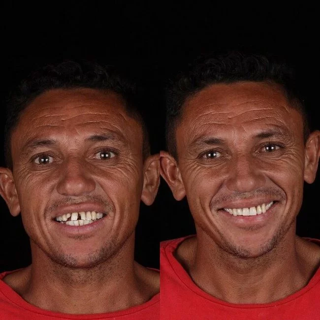 Дантист из Бразилии возвращает красивые улыбки людям, которые не могут оплатить операции Стоматолог, Гуманитарная помощь, Добрые дела, Длиннопост