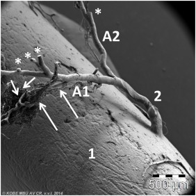 Did you know that vessels also have vessels? - The medicine, Biology, Blood vessels, Informative, Artery