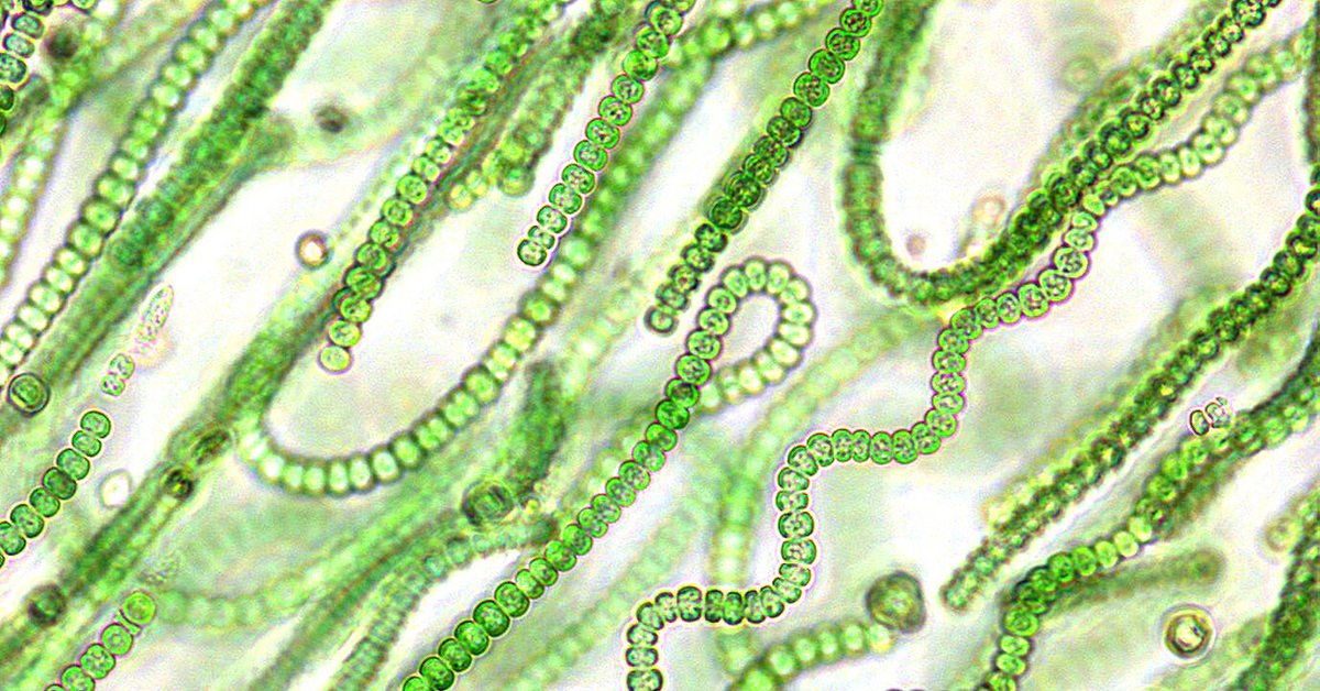 Клетки водорослей и цианобактерий. Синезелёные водоросли цианобактерии. Носток цианобактерия. Клетка цианобактерии Anabaena. Фотосинтезирующие цианобактерии.