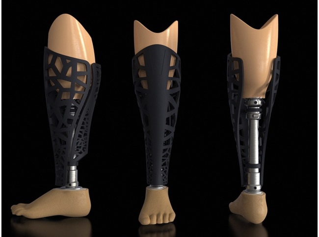 Onlay on the prosthesis, need help! - My, Help, The strength of the Peekaboo, Disabled person, Longpost