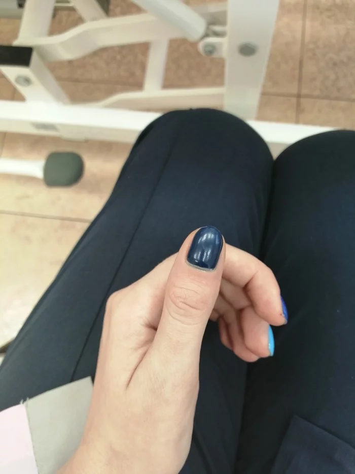 Response to the post Life hack with broken nails, or how not to suffer when the nail turned blue - My, Useful, ethnoscience, First aid, Nails, Injury, Reply to post, Longpost