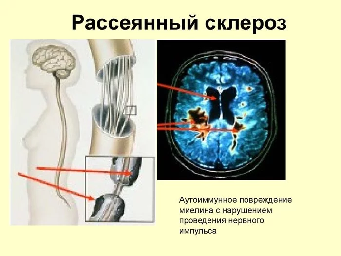 Продолжение поста «Моники. Институт по лечению рассеянного склероза. Москва, но не для москвичей, для области» - Моё, Больница, Врачи, Институт, Рассеянный склероз, Ответ на пост