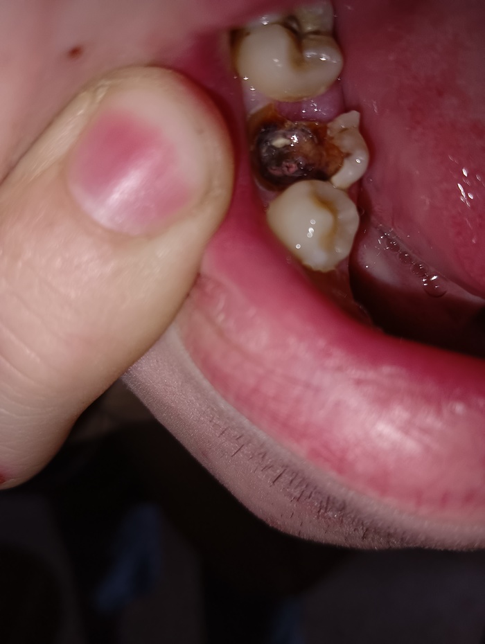 ����� ������ � �����