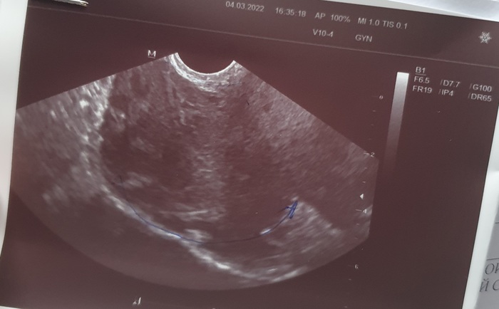 �����, �����, �����