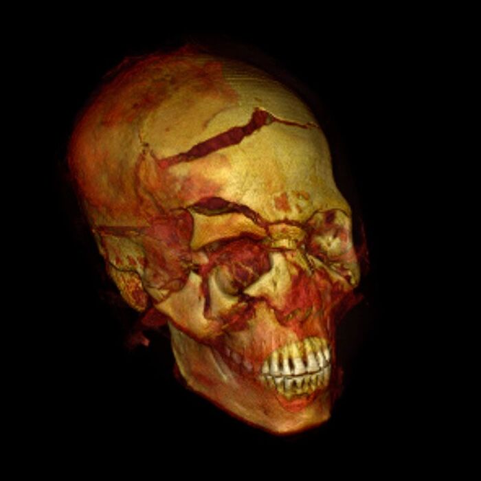 Лучшие научные фото февраля. Жестокая атака