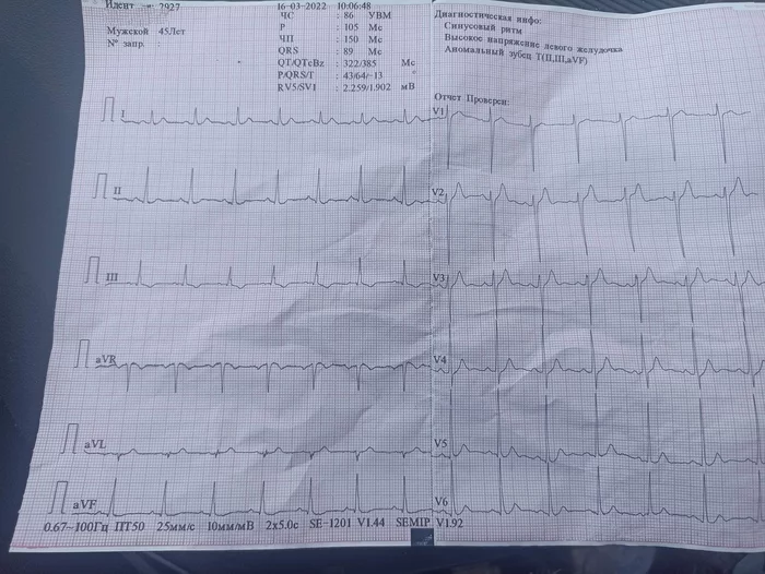 My heart is tired - Health, Heart, Cardiogram, No rating, Doctors need help, Disease history, 