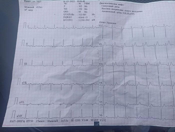 Моё сердце устало - Здоровье, Сердце, Кардиограмма, Без рейтинга, Нужна помощь врачей, История болезни, 