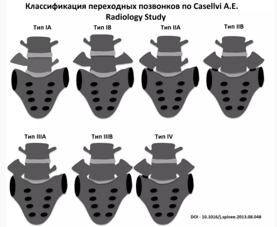 На примере немного о том, как мы лечим людей через ошибки и боль, но иногда достигаем успеха - Моё, Медицина, Здоровье, Лечение, Боль, Неврология, История болезни, Спина, Истории из жизни, Длиннопост