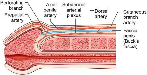 Varicocele, complications after surgery - My, Varicocele, Hernia, Circumcision, Complication, The medicine, Urology, Longpost