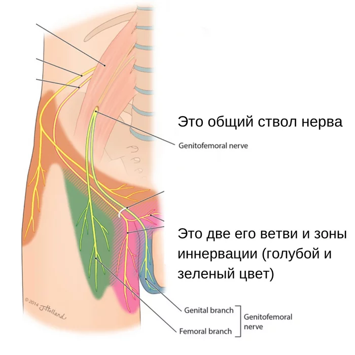 For 30 years I burned my thigh and groin. Clinical case of neuropathy of the femoral-genital nerve. Cured - My, The medicine, Health, Treatment, Pain, Nerves, Disease history, Story, Video, Youtube, Longpost