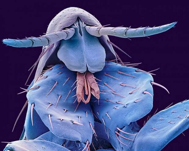 Insects under a microscope - Insects, The photo, The science, Interesting, Longpost, 