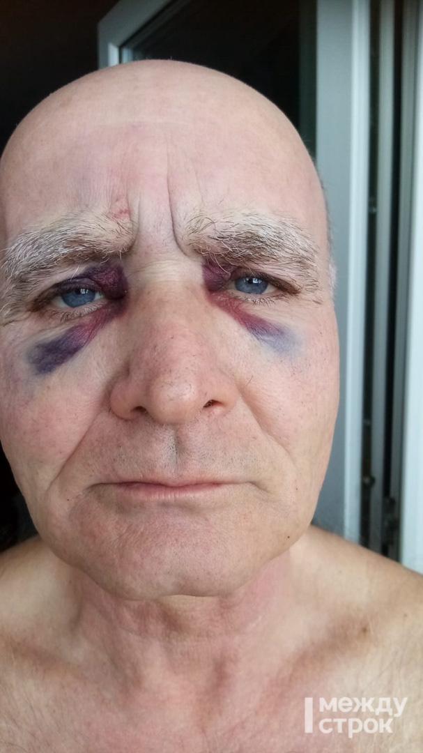 В Нижнем Тагиле отловщики диких животных БФ «Добрые руки» избили охранника-пенсионера