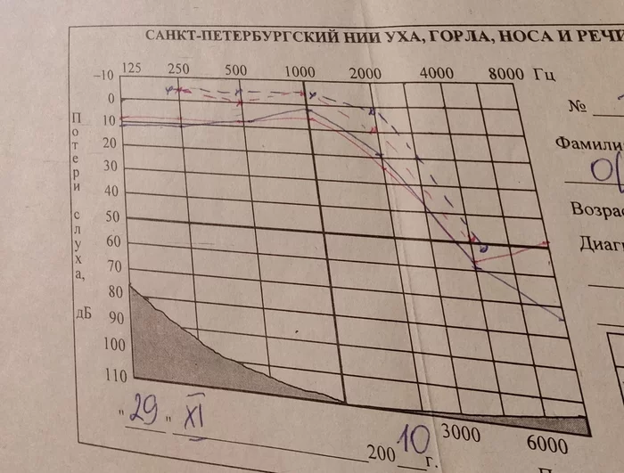 Poor hearing. Diagnosis. What do you recommend? - My, Hearing, Diagnosis, ENT-Doctors, No rating