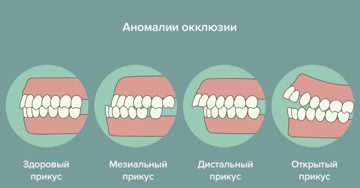 Что значит с открытым ртом