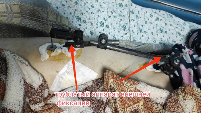 ������� ����� ����������, ������, ������� ����, ���������, ��������