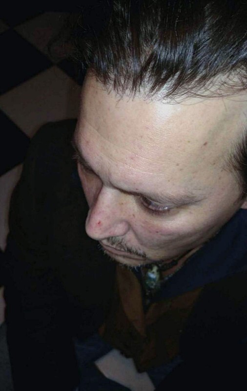 Photographs of beaten Johnny Depp shown in court after quarrels with Amber Heard - Actors and actresses, Celebrities, USA, Johnny Depp, Society, Hollywood, Women, Court, Men, Men and women, Deception, Treason, Amber Heard, Feces, Longpost, Negative