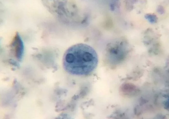 Looking through a microscope for a long time... - Microscope, Amoeba, Reddit, Sight, The photo, Pareidolia