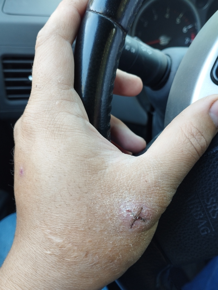 ����� �� �������