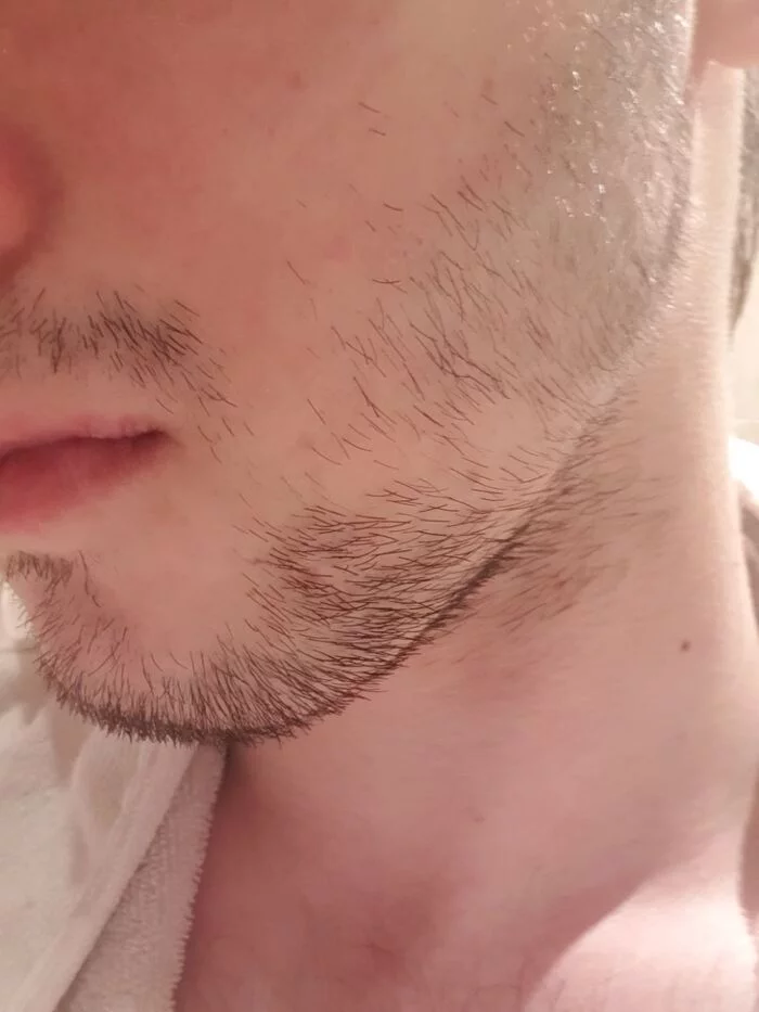 Bad facial hair, what to do? - My, Need advice, Question, Problem, Vegetation, Face, Health, Men, Beard