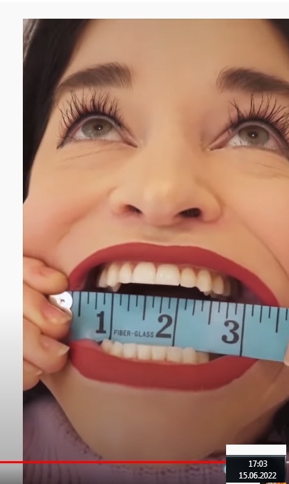 Size matters? - Big Mouth, Mouth, Ruler, Banter League