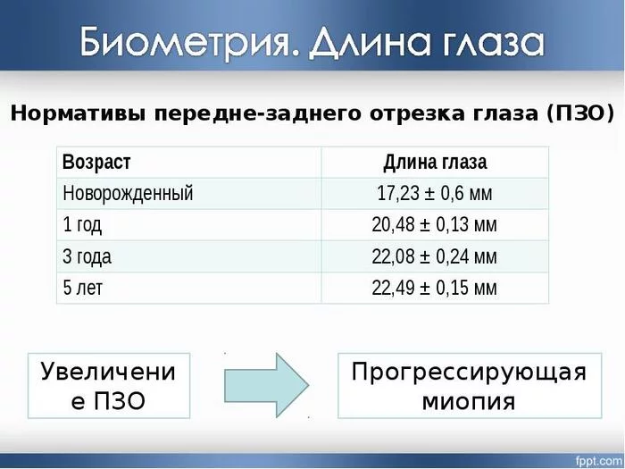 Миопия. Близорукость - Медицина, Больница, Здоровье, Операция, Офтальмология, Лазерная коррекция, Длиннопост