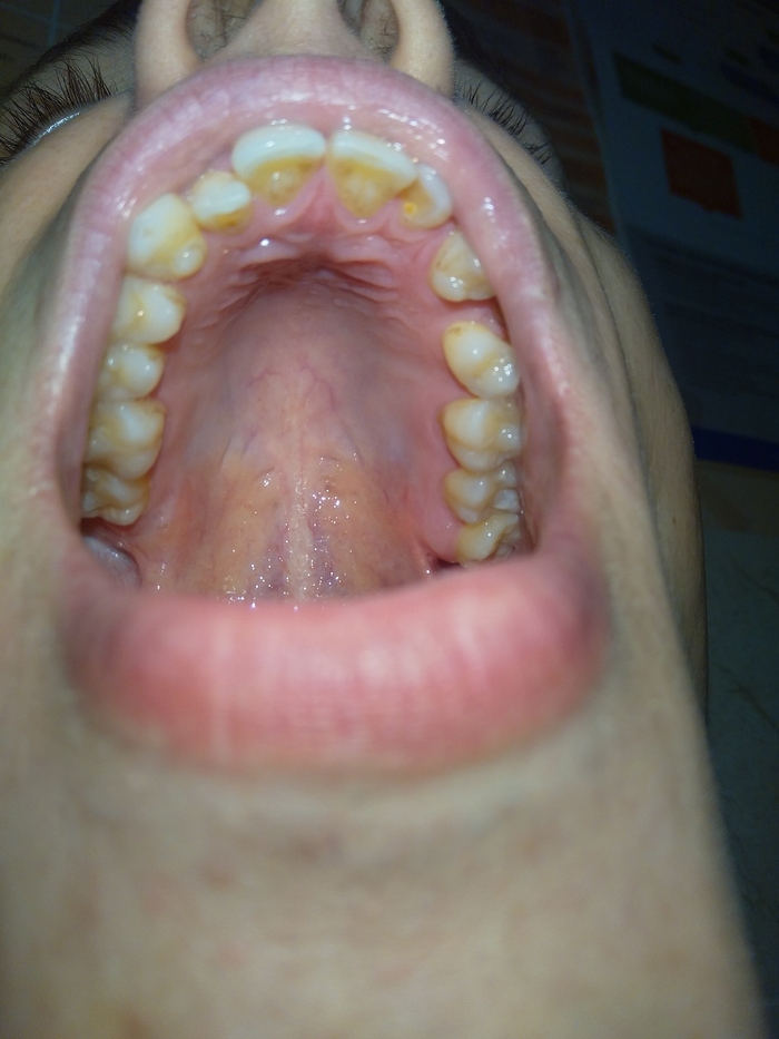      ? , , , ,   