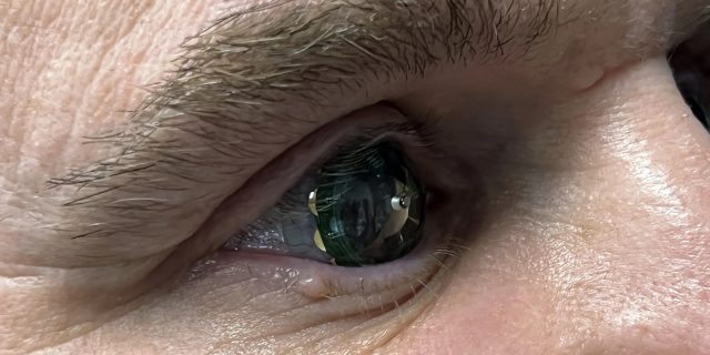 Augmented reality lenses Mojo Lens successfully tested: they were put on by the founder of the company - Contact lenses, Augmented reality, Longpost, Technologies, Prototype