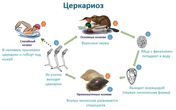 Bathers' itch (Cercariasis) - My, Ambulance, Pediatrics, Worms, Parasites, The medicine, Itch, Scratching