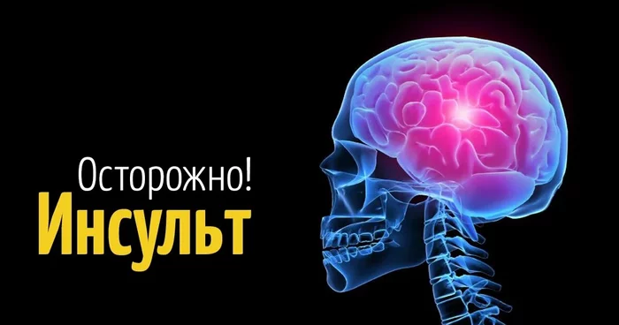 Мой микроинсульт в 23 года и вес 112 кг из за сидячей работы - Моё, Python, Программист, Программирование, IT, Здоровье, Питание, Правильное питание, Здоровое питание, Неправильное питание, Йога, Бег, Бокс, Боксёр, Саморазвитие, Длиннопост