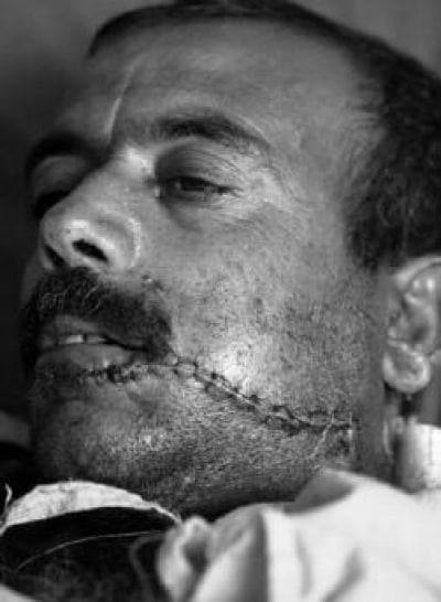 Улыбка Глазго