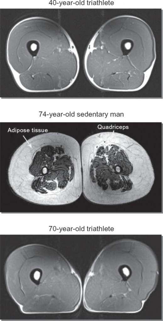 How to slow down aging and why do you need muscles for this? - My, Longpost, Sport, Old age, Health, Motivation, Fitness, Muscle, A life