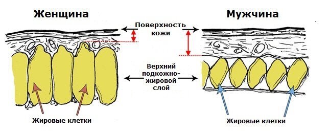 Про целлюлит - Моё, Длиннопост, Текст, Здоровье, Фитнес, Красота, Уход за собой, Целлюлит