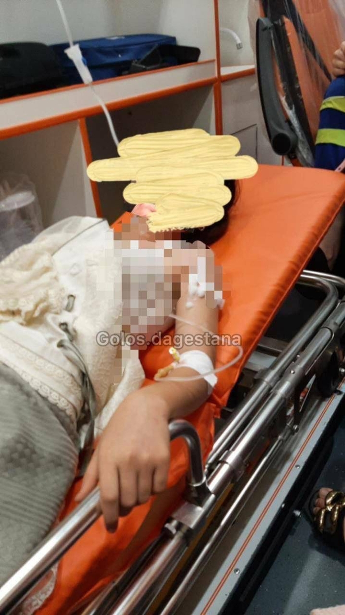 В Дагестане ребёнок получил ожоги в результате воспламенения газовых шаров