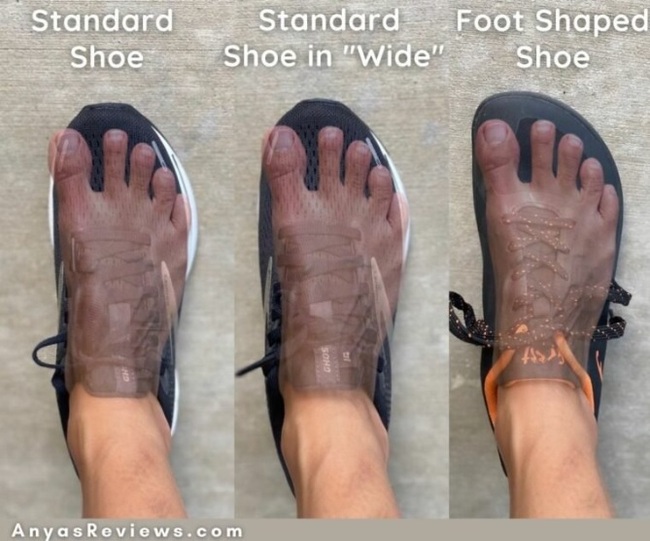 О плоскостопии, босоногой обуви (barefoot), вальгусе, вреде каблуков и  заговоре ортопедов | Пикабу