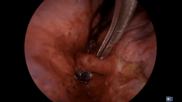 Something cool from surgery - My, Operation, The medicine, Surgery, Radiology, Disease, GIF, Longpost, Disease history