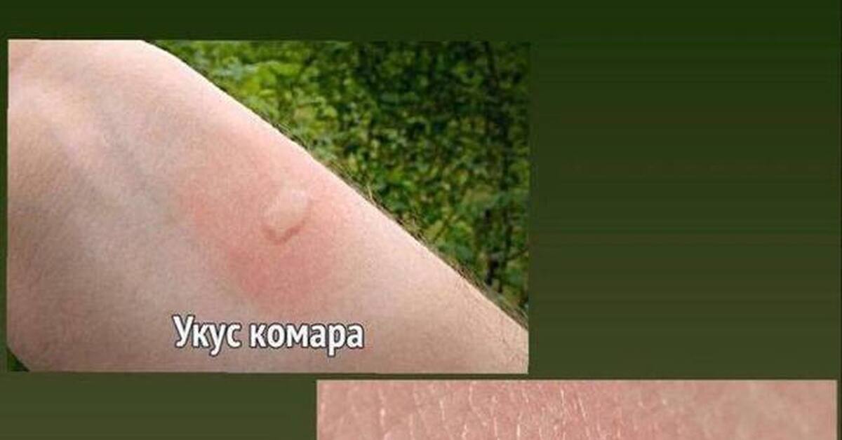 Самый болезненый укус | Пикабу