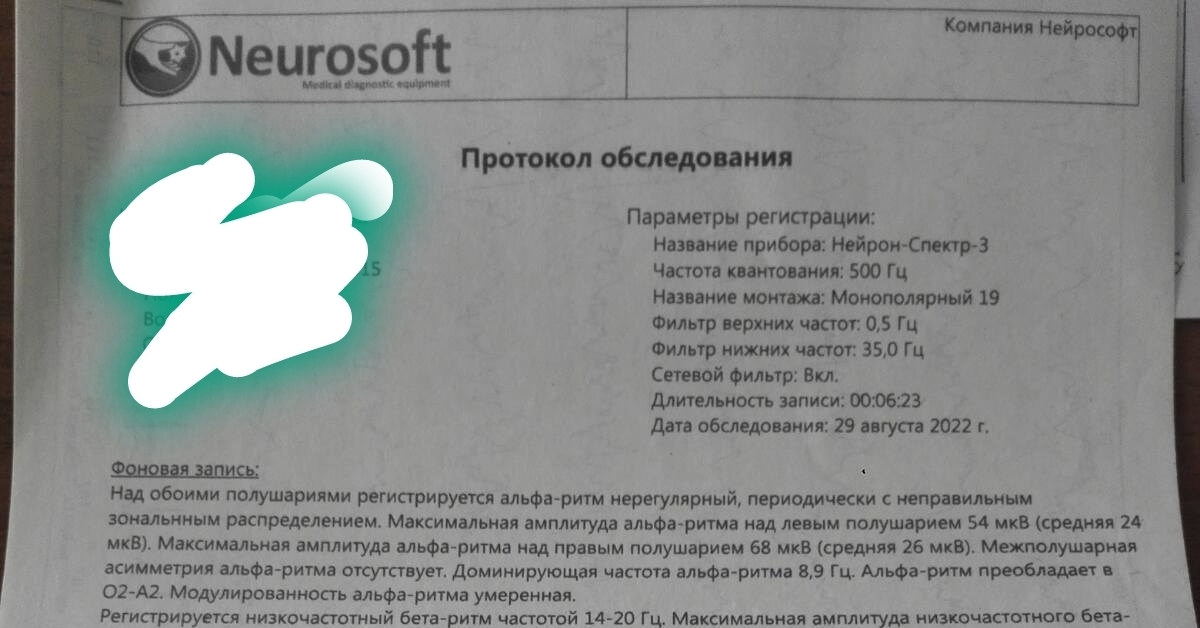 Расшифровка ээг и экг | Пикабу