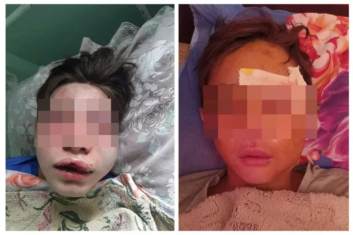 Teenagers raped a girl for several years. Fellow villagers - about the beating that stirred up a quiet Yakut village - Negative, The crime, Police, Yakutia, Teenagers, Ministry of Internal Affairs, Beating