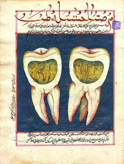 Turkish dentistry of the 18th century - Story, Dentistry, 18 century, The photo, The medicine, Teeth