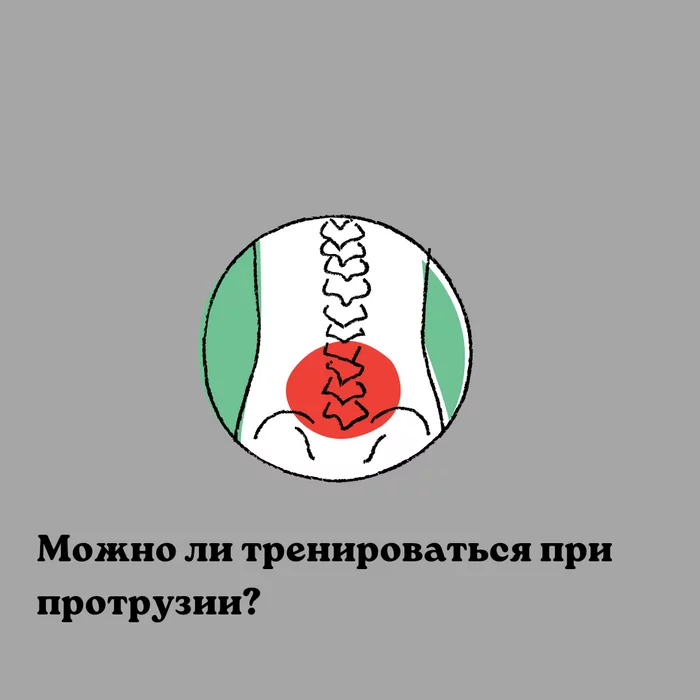 Можно ли тренироваться при протрузии? - Моё, Фитнес, Здоровье, Осанка, Протрузия, Тренировка, Тренер, Фитнес-Тренер, Длиннопост, Тренажерный зал