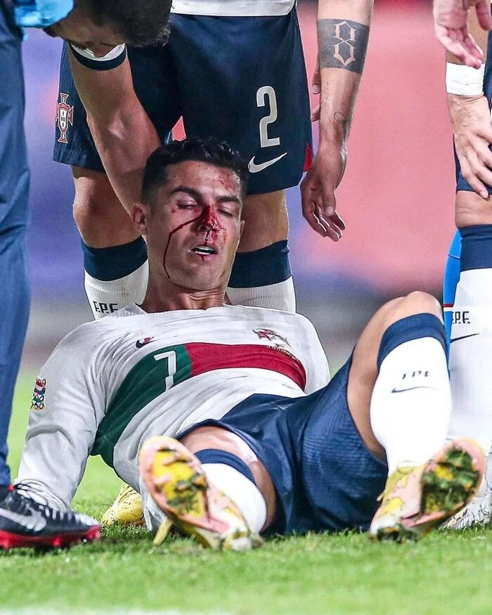 Ronaldo got punched in the nose by a Czech - Football, Europe, League of Nations, Cristiano Ronaldo, Portugal, Nose, Blood, Injury, Video, Longpost