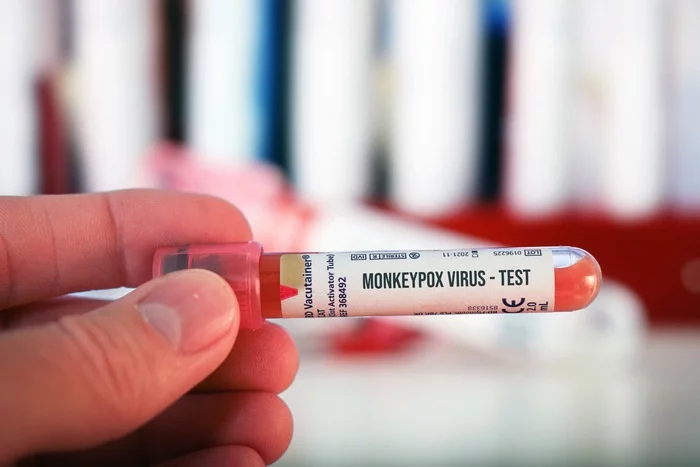 Helsinki offers free monkeypox vaccination to all at-risk groups - Finland, Monkeypox, Vaccination, news