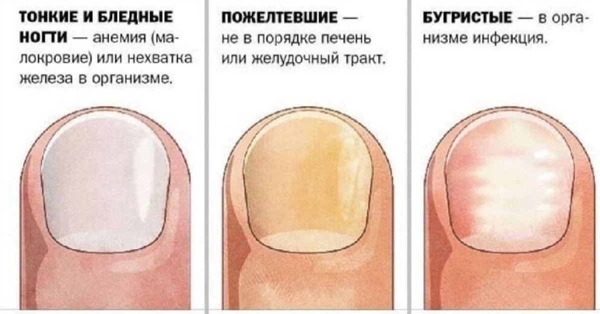 Форма ногтей и болезни человека фото и описание