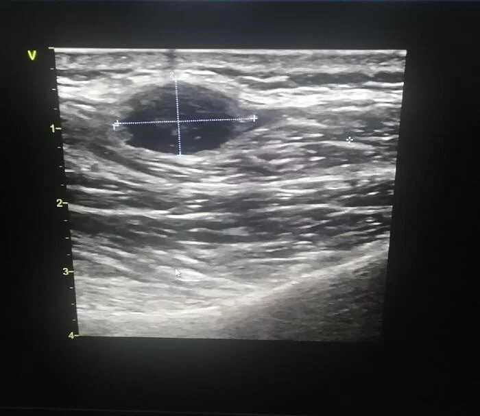 What does the doctor see during an ultrasound? - My, The medicine, Doctors, Hospital, Ultrasound, Diagnostics, Longpost