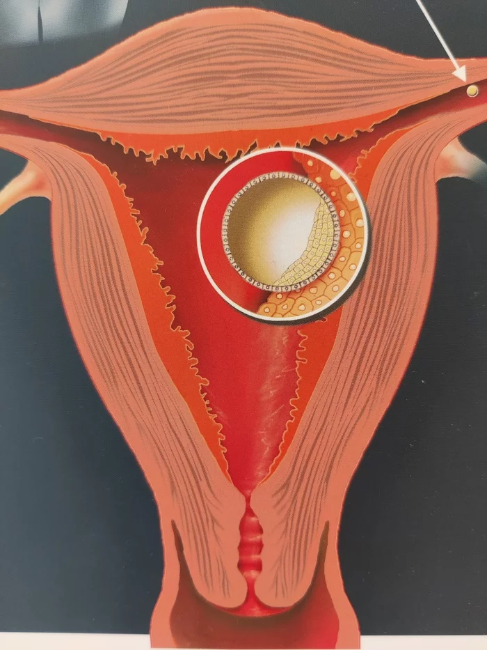 Пост #1. Менструальный цикл: вид на происходящее изнутри. Глава первая - Моё, Месячные, ЭКО, Бесплодие, Медицина, Репродукция, Гинекология, Гинеколог, Беременность, Длиннопост