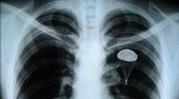Presumably this is what a paratrooper's heart looks like :) - My, Airborne forces, SSO, Landing, X-ray, Heart and lungs, Heart